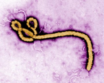 4 reasons Ebola has been underestimated 4 reasons Ebola has been underestimated